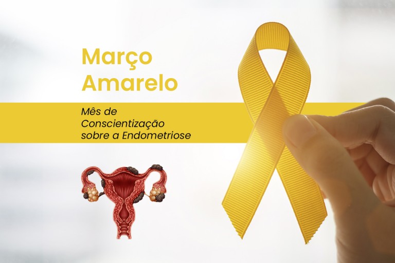 Março Amarelo- Prevenção à endometriose